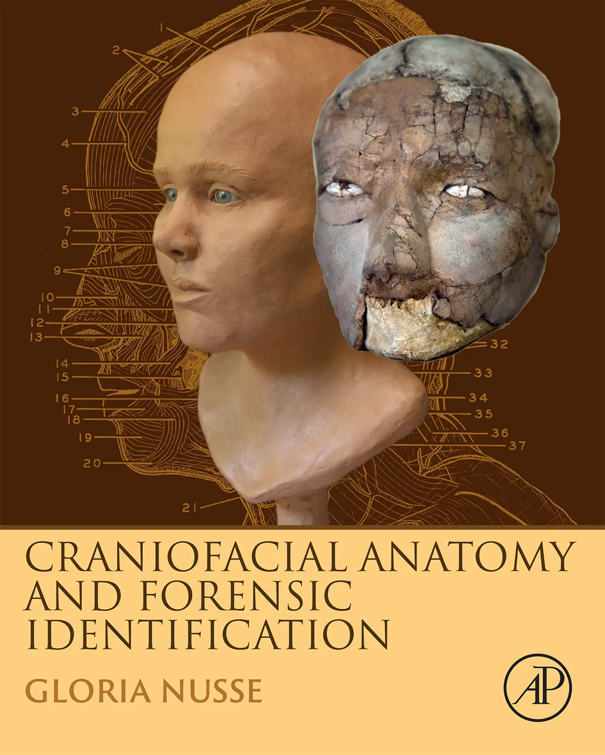 Craniofacial Anatomy and Forensic Identification by Gloria Nusse