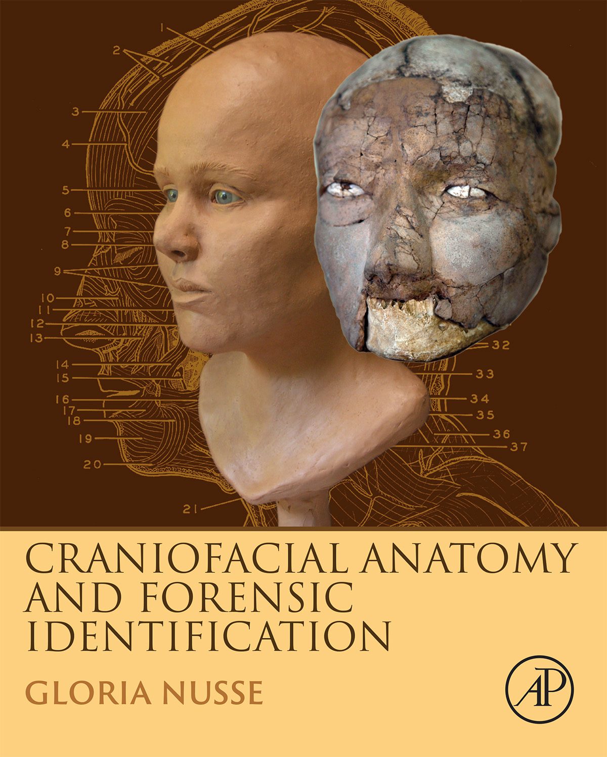 Craniofacial Anatomy and Forensic Identification by Gloria Nusse